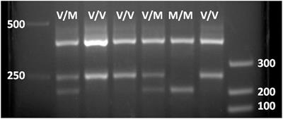 The Val66 and Met66 Alleles-Specific Expression of BDNF in Human Muscle and Their Metabolic Responsivity